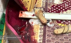 بستری ۶ مجروح حمله آمریکا به کوهستک در بخش مراقبتهای ویژه بستری ۶ مجروح حمله آمریکا به کوهستک در بخش مراقبتهای ویژه